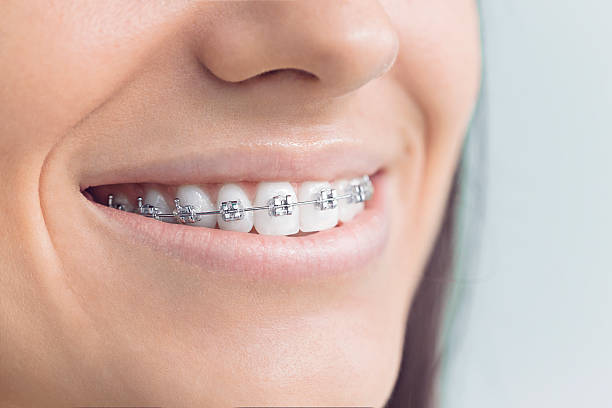 Best Traditional Braces  in Fairplains, NC
